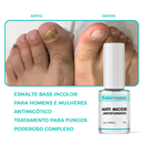 Esmalte Antifúngico DiaPharma™
